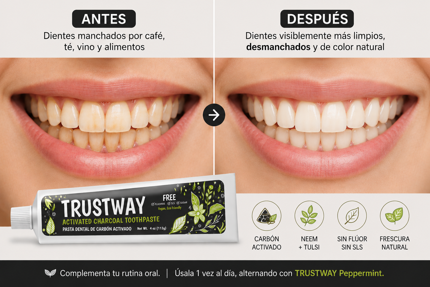 🖤 Recupera el color natural de tu sonrisa -Trustway